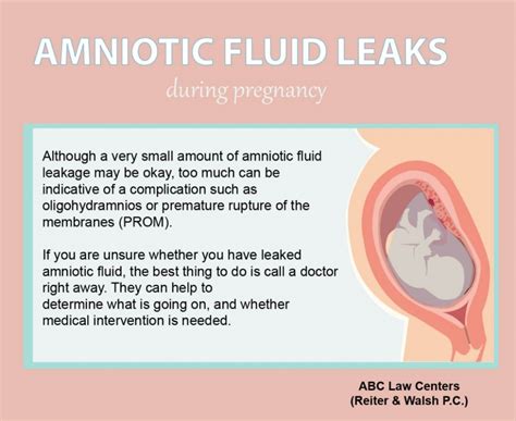 what causes amniotic fluid to leak|Leaking amniotic fluid (premature rupture of membranes)